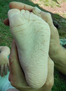 Prune feet
